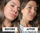 CeraVe Blemish Control Gel Moisturiser before and after skin results - CeraVe skincare product image