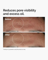 The Ordinary Niacinamide 10% + Zinc 1% 30ml